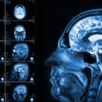 Different views of MRI of the human brain